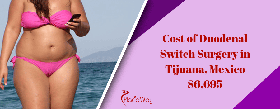Cost of Duodenal Switch Surgery in Tijuana, Mexico
